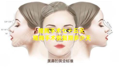 隆胸手术七十五天 隆胸手术恢复期多少天
